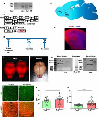 Tsc2 shapes olfactory bulb granule cell molecular and morphological characteristics